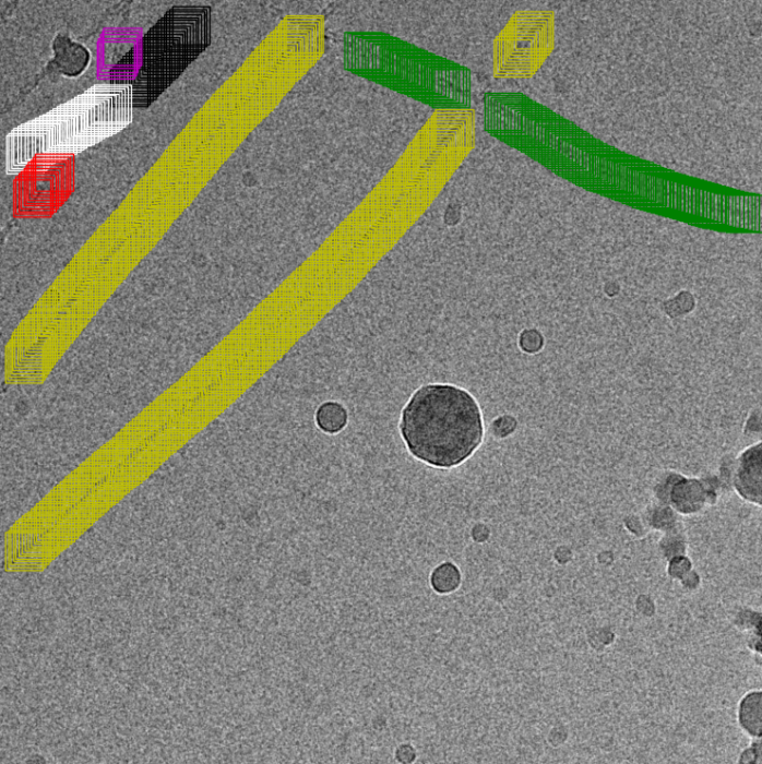 ../_images/actin_tracing_1.png